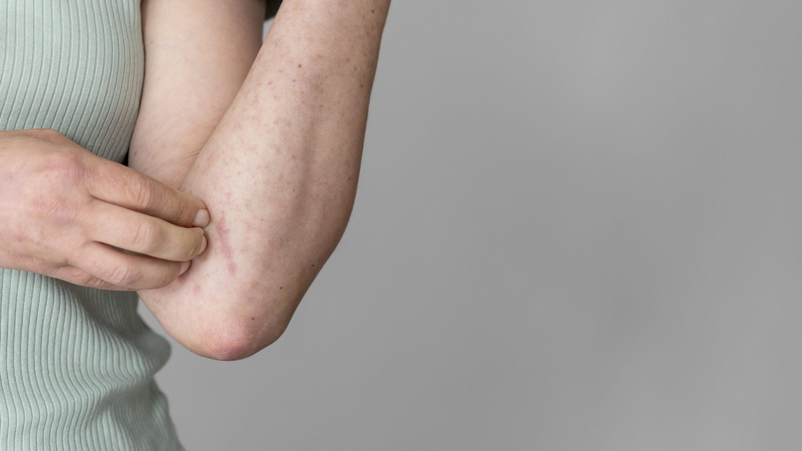 Smallpox The History and Impact of a Devastating Disease - Worldwidedigest