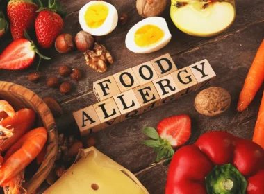 Food Allergies