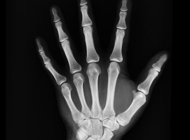 X Ray