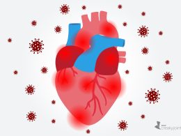 COVID-19 Affects the Heart