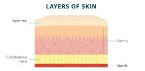 Epidermis