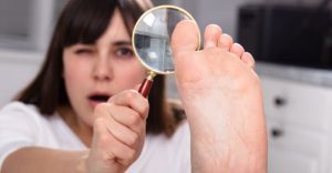 Toenail Troubles and Remedies