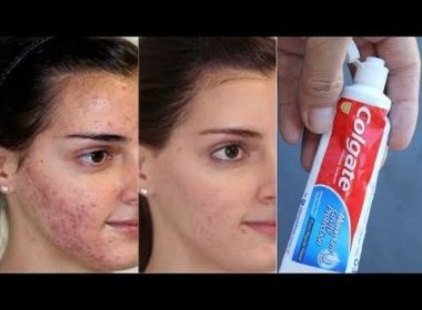 Vaseline Duo