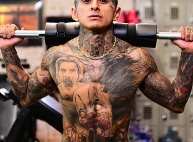 Tattoo Allergic