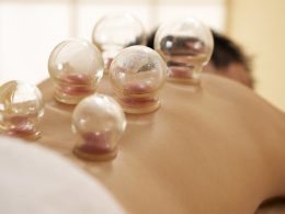 Benefits of Cupping