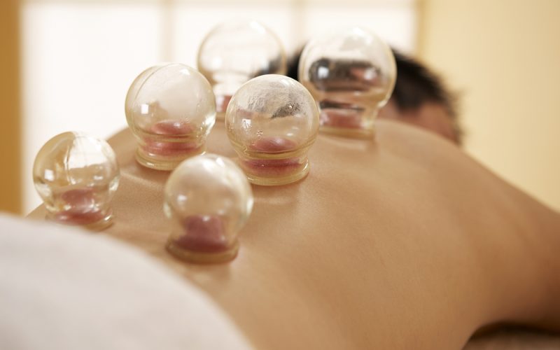 Benefits of Cupping