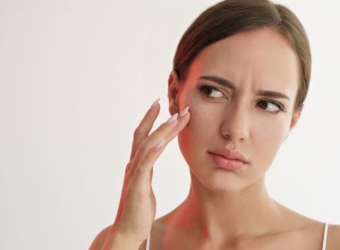 Winter Skin Woes