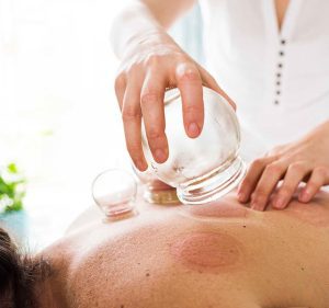 Benefits of Cupping 