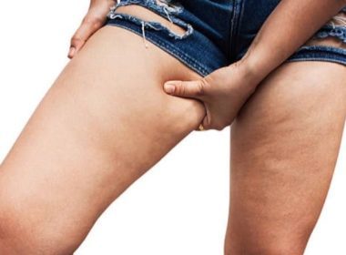 Thigh Fat Farewell