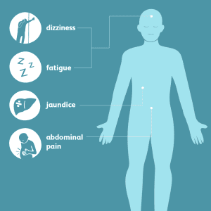 Gilbert’s Syndrome