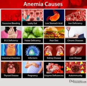 Iron Deficiency Anemia