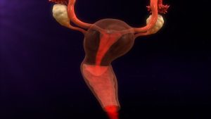 Unusual Uterine Bleeding