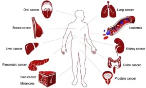 Alcohol and Cancer Risk