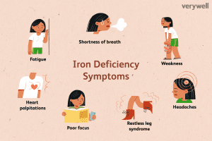 Iron Deficiency Anemia