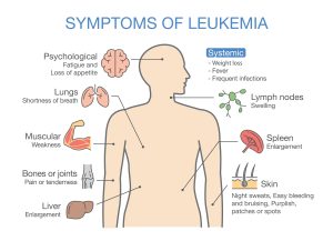 Navigating Leukemia