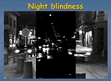 Night Blindness