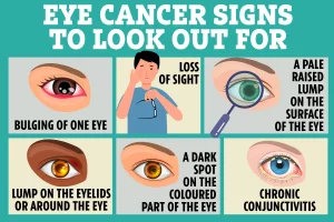 Types of Eye Cancer