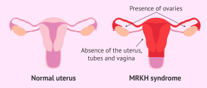 Unusual Uterine Bleeding