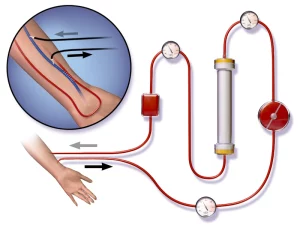 Blood Transfusion Recipients