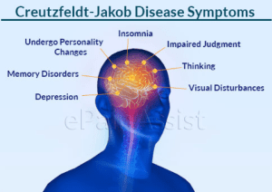 Jakob Disease