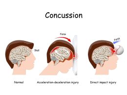 concussion symptoms and signs