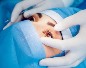 Dropless Cataract Surgery