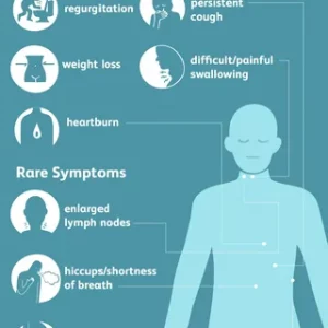 Esophageal Cancer