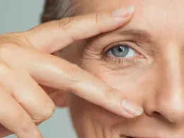 Eye Problems with Aging