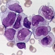 Germ Cell Tumors