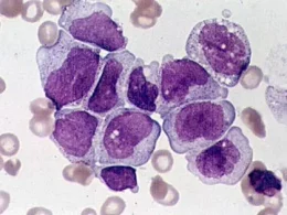 Germ Cell Tumors