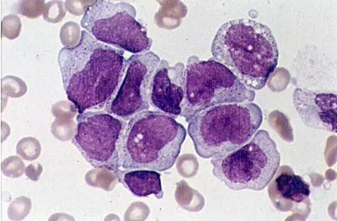 Germ Cell Tumors