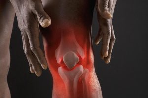 Knee Arthritis