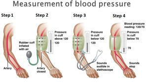  Home Blood Pressure Monitoring