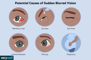 Sudden Vision Loss