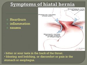 Hiatus Hernia