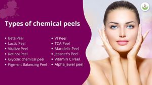 Types of Chemical Peels, advance chemical peel treatment, chemical peel treatment for pigmentation 