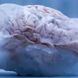 Brain Freeze