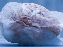 Brain Freeze