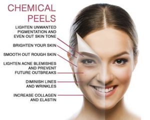 Understanding Chemical Peels, advance chemical peel treatment, chemical peel treatment for pigmentation 