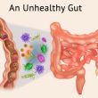 Unhealthy Gut