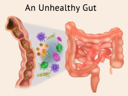 Unhealthy Gut