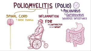 Dangers of Poliovirus