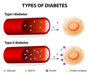 COVID-19 and Diabetes
