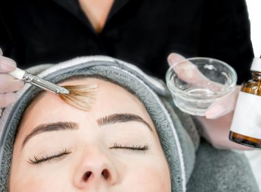 Advanced Chemical peel treatment