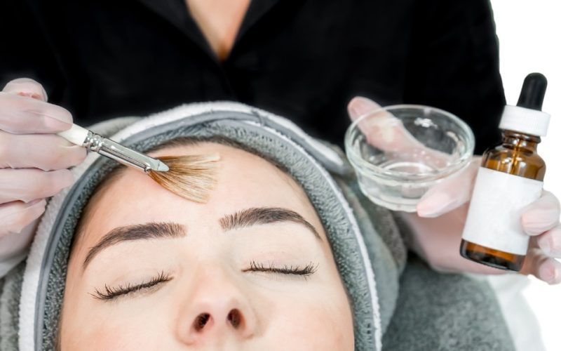 Advanced Chemical peel treatment