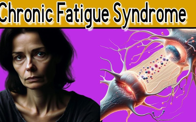 New Research on Chronic Fatigue Syndrome and Treatments