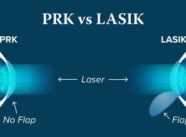 PRK vs LASIK
