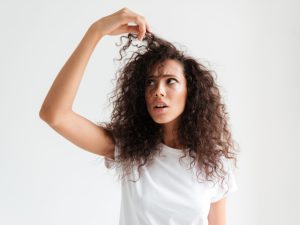 Hair Loss in Alopecia