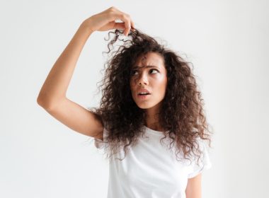 Hair Loss in Alopecia