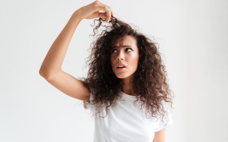 Hair Loss in Alopecia